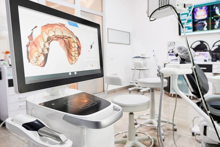 cerec digital intraoral scanner displaying 3-d imaging results of the top row of teeth