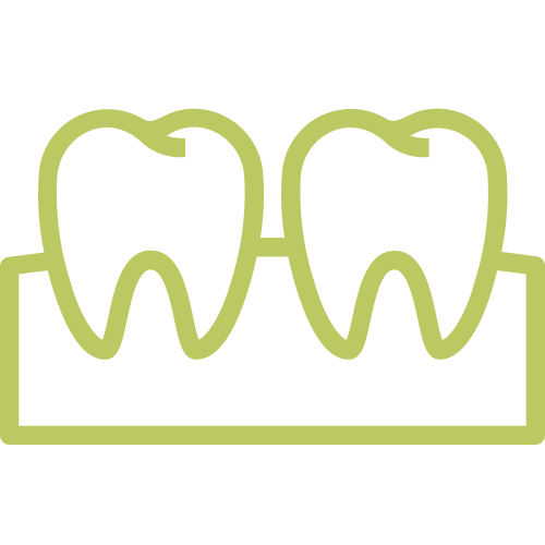 Dental Inlays and Onlays